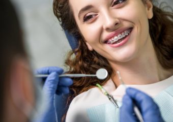 Aparat na zęby – ile kosztuje i co wpływa na jego cenę?